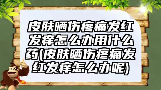 皮膚曬傷疼痛發(fā)紅發(fā)癢怎么辦用什么藥(皮膚曬傷疼痛發(fā)紅發(fā)癢怎么辦呢)