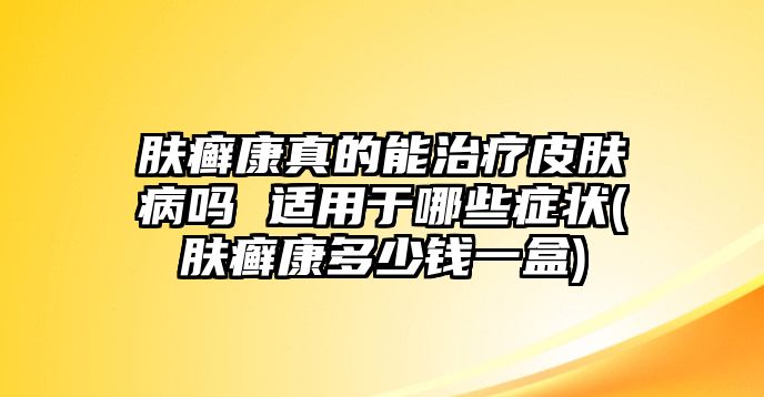 膚癬康真的能治療皮膚病嗎 適用于哪些癥狀(膚癬康多少錢一盒)